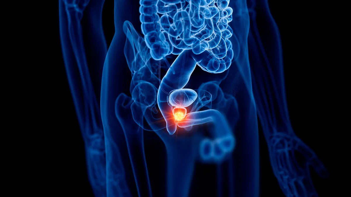 Medical illustration of the lower abdomen with the prostate area lit from within